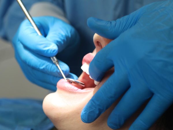 dental fillings in hythe