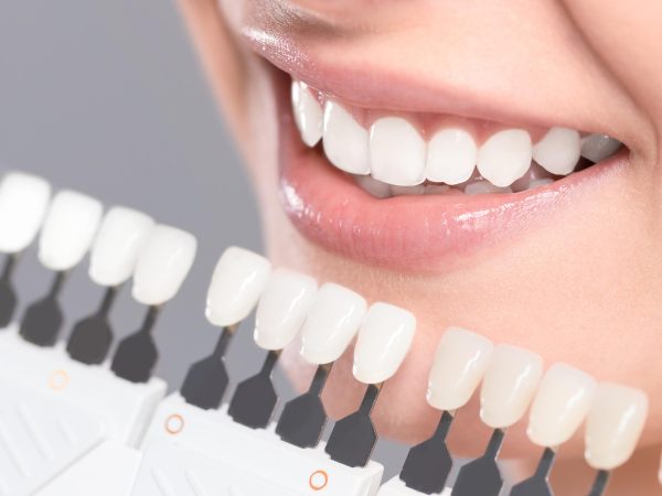 dental crown price southampton
