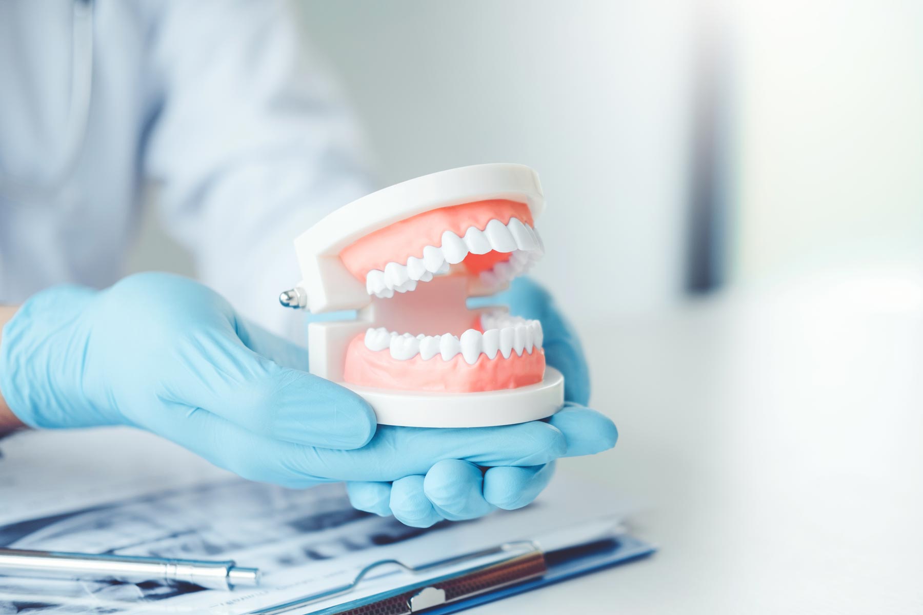 Dental Implants Vs Dentures – The Pros & Cons