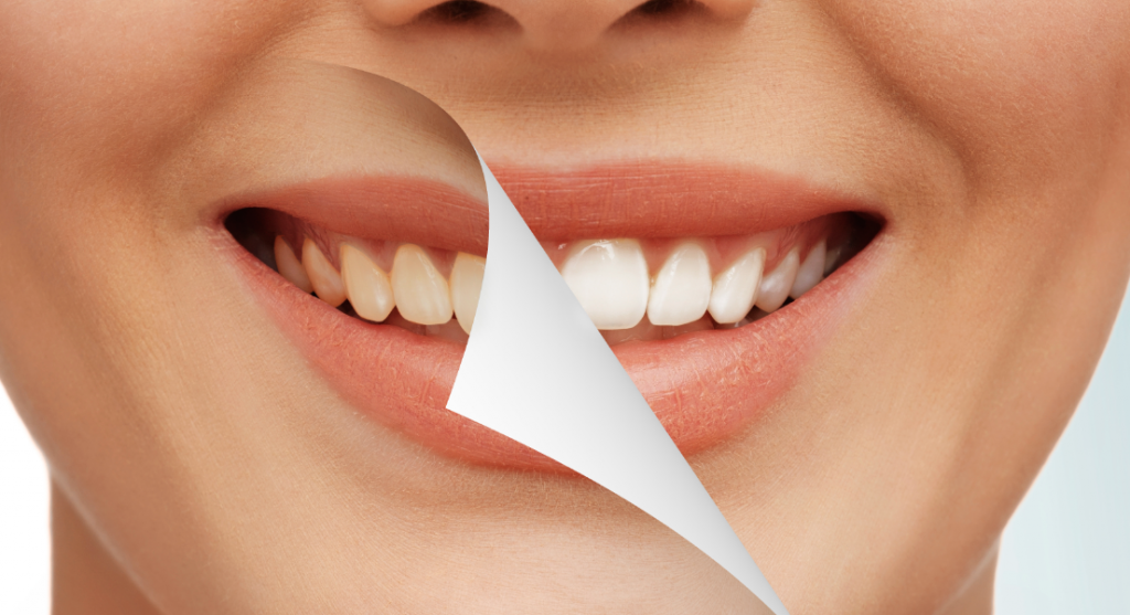 cosmetic dentistry cost