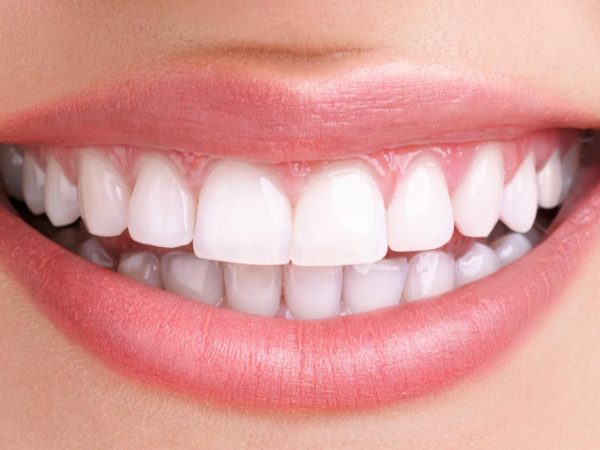 before and after dental treatment