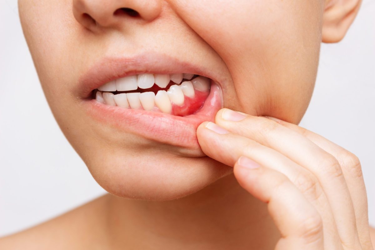gum disease symptoms and causes