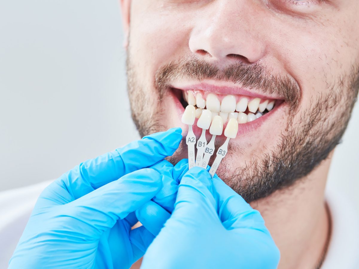 Is Cosmetic Dentistry Worth It?