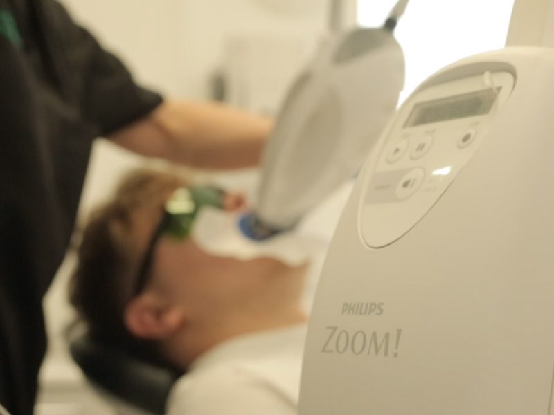 quick teeth whitening southampton