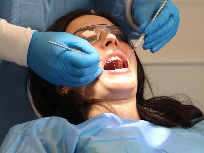 quick teeth whitening southampton