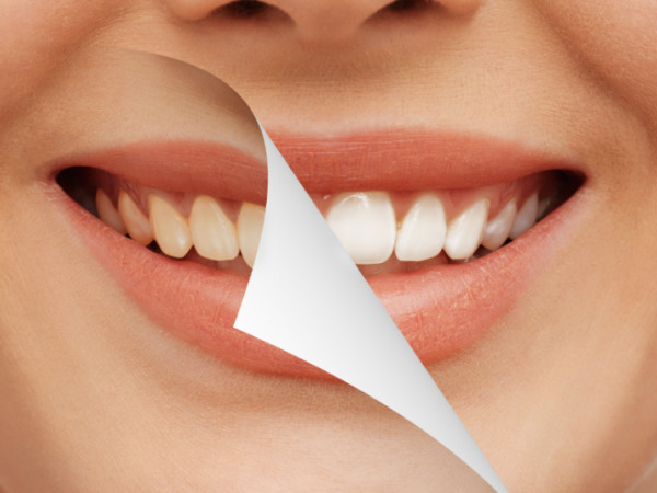 cosmetic dentistry cost
