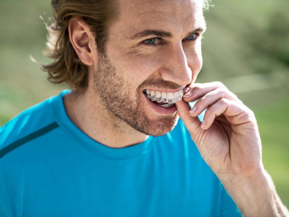 invisalign-braces-near-me-Bassett