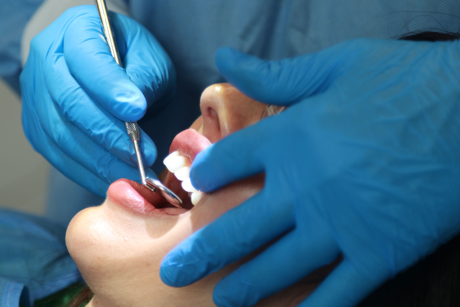 full dental implants cost ringwood
