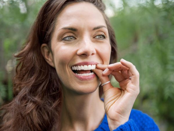 transparent invisalign retainers for adults totton