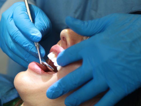 dental cleaning services in Lymington